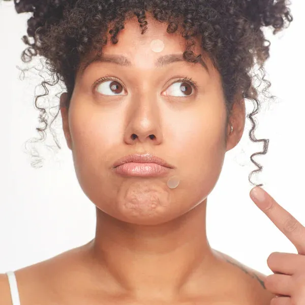 Breakout Box - 3 in 1 Acne Treatment